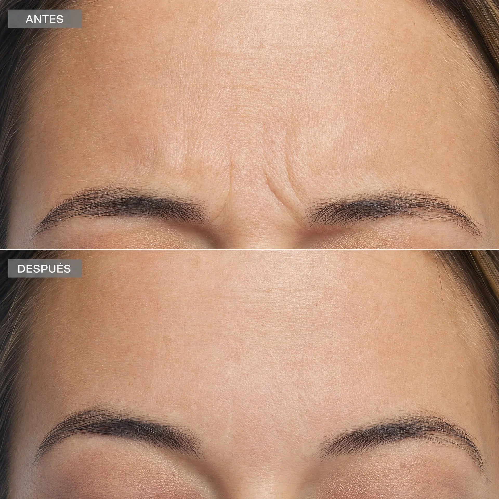 Retinal - Shot Skin Booster